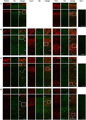 Neuroserpin Is Strongly Expressed in the Developing and Adult Mouse Neocortex but Its Absence Does Not Perturb Cortical Lamination and Synaptic Proteome